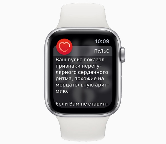Функция ЭКГ на Apple Watch.