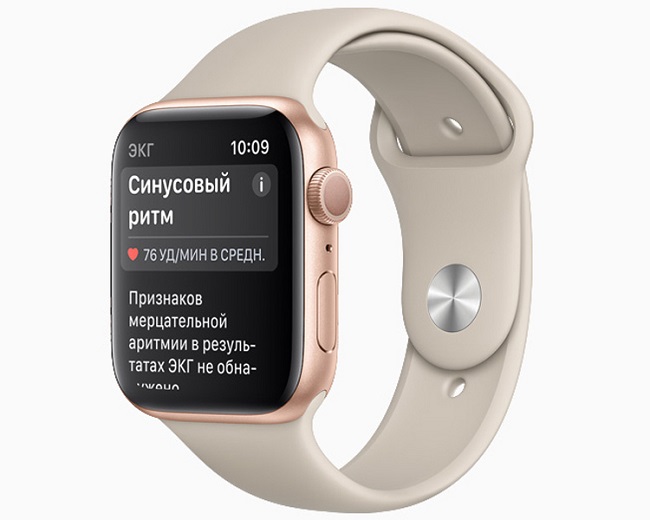 Функция ЭКГ на Apple Watch.