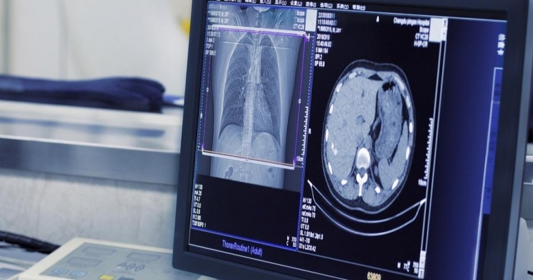 В Челябинске запустили пилотный сервис по предиктивному анализу рентгеновских снимков и компьютерной томографии.